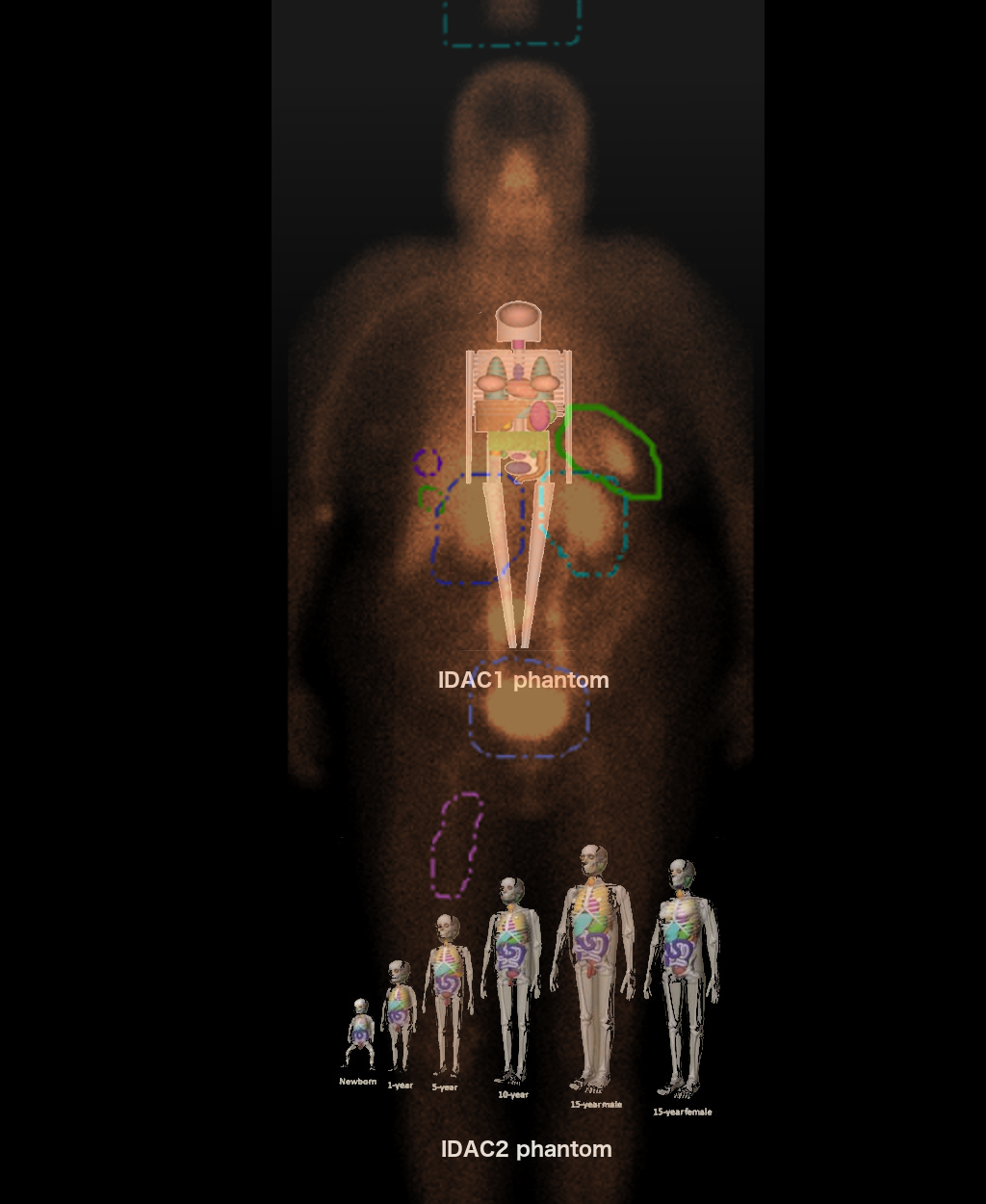 Advanced Molecular Planar image dosimetry with IDAC-dose