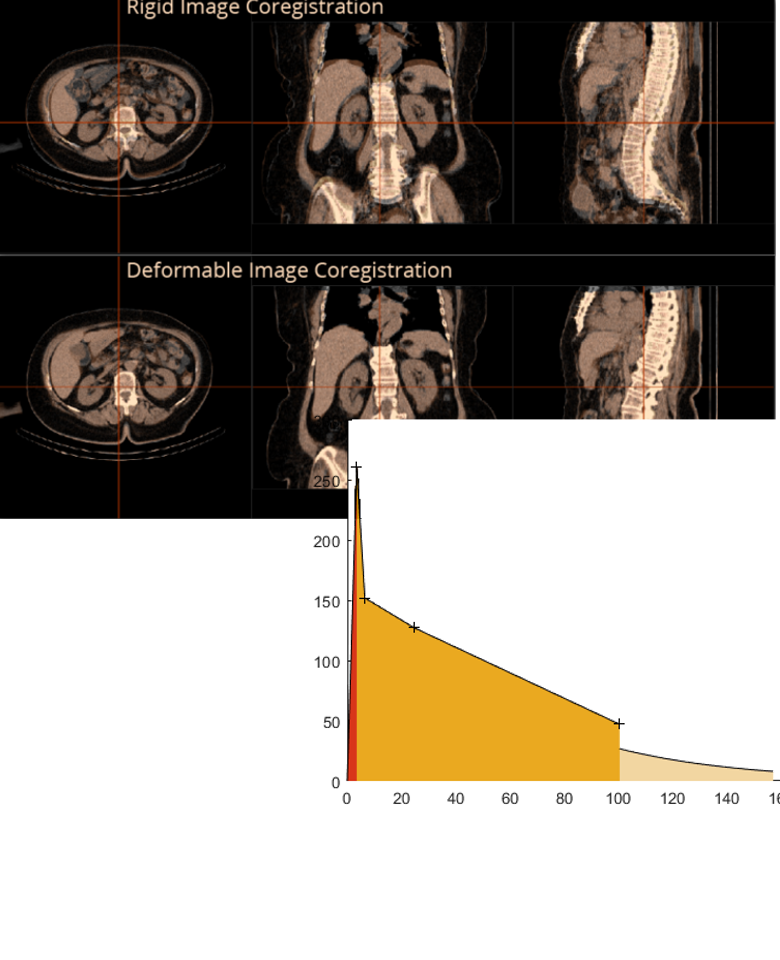 Automatic non-rigid coregistration Powerful curvefitting